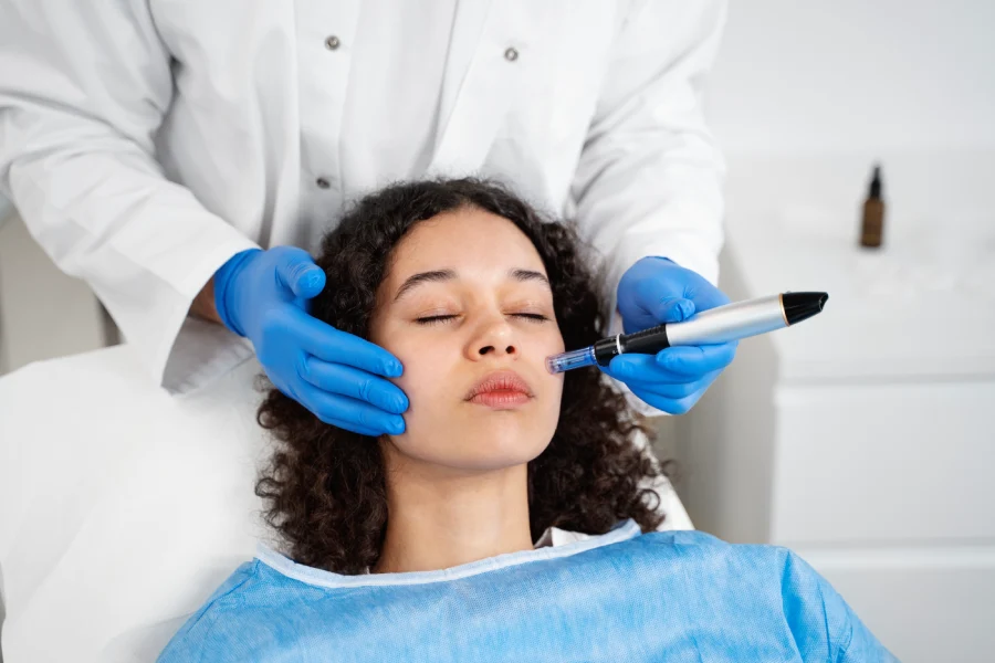 Microneedling treatment
